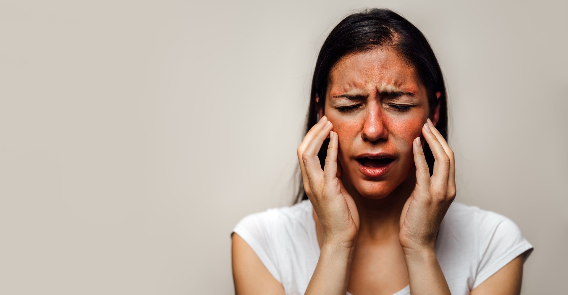 Modelo com manchas vermelhas no rosto e fazendo expressão de dor